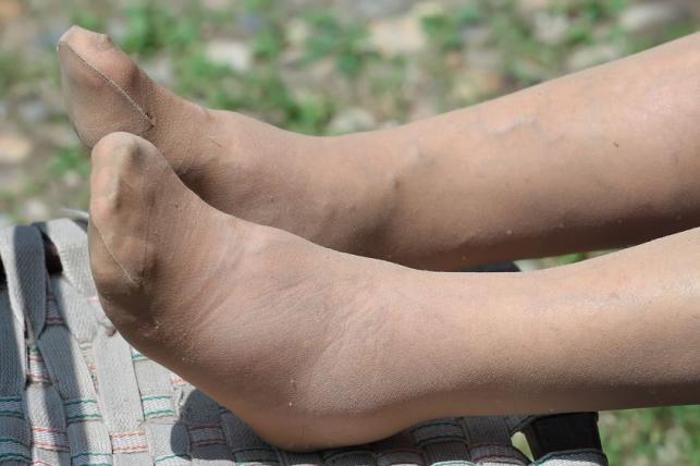 lapos láb és a csípőízület fájdalma a bal térdízület belső meniszkuszának degeneratív károsodása