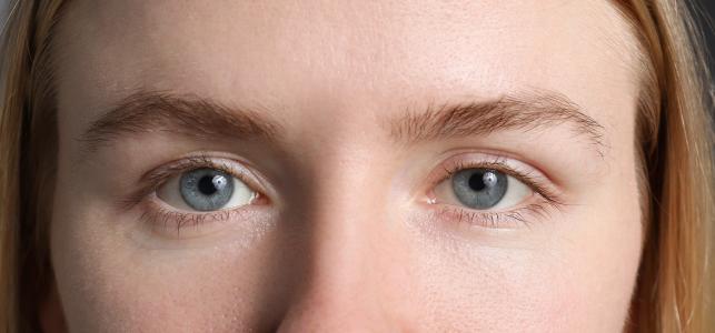 Rejtett szemhéj Fotó: 123rf.com - PROAKTIVdirekt Életmód magazin és hírek - proaktivdirekt.com