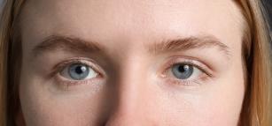 Rejtett szemhéj Fotó: 123rf.com - PROAKTIVdirekt Életmód magazin és hírek - proaktivdirekt.com